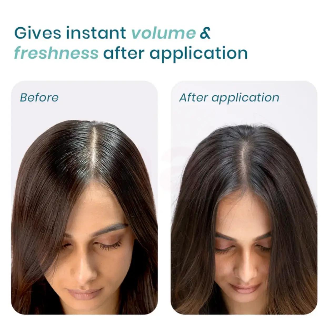 WishCare Air Powder Dry Shampoo 10 gm