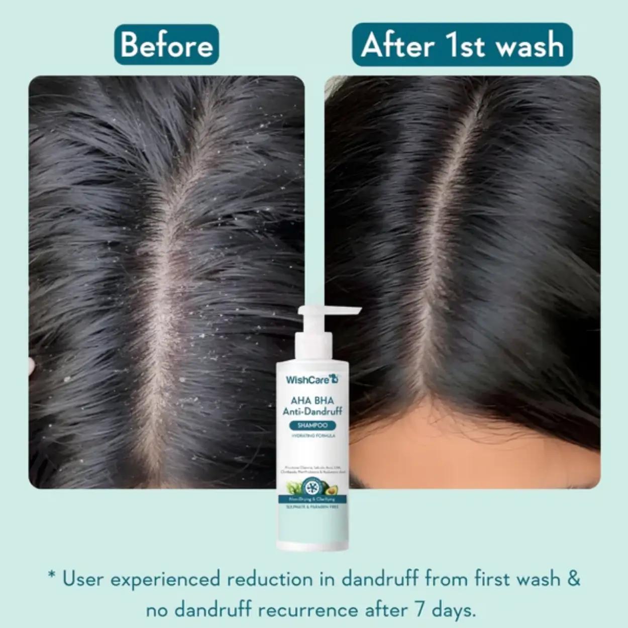 Wishcare AHA BHA Anti-Dandruff Shampoo