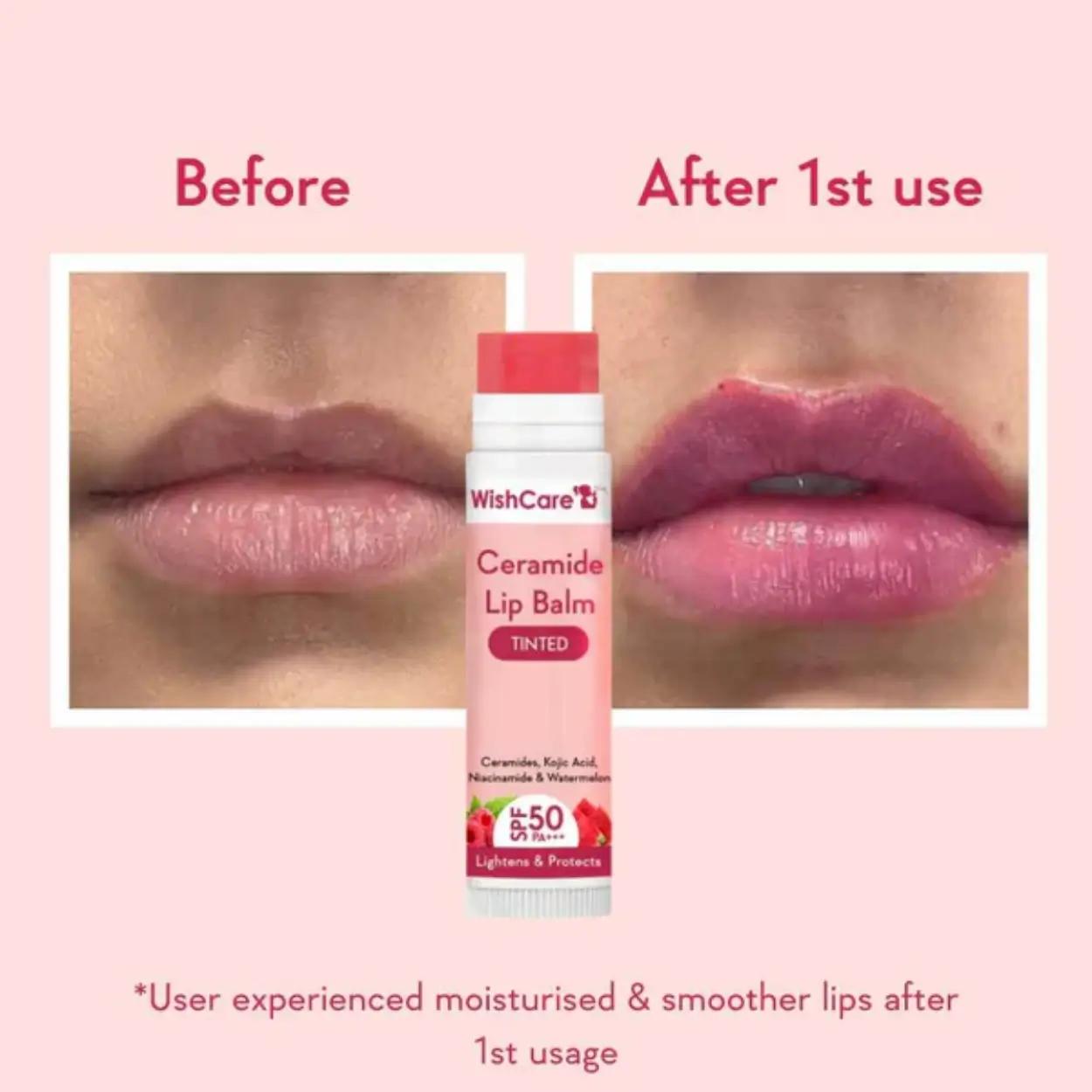 WishCare Ceramide Lip Balm Tinted with SPF 50 PA+++ 5gm